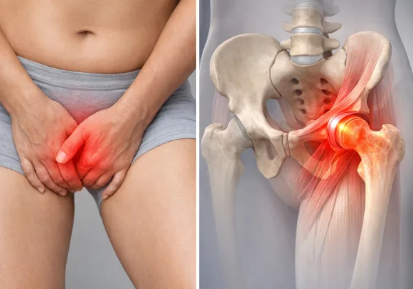 groin pain hip arthritis