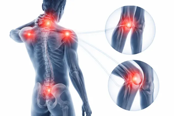 neck stiffness and joint pain connection