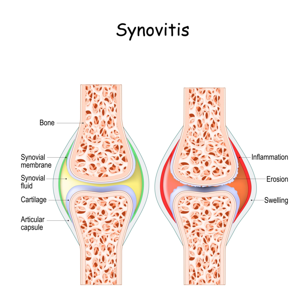 air conditioning and joint pain